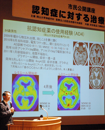 認知症の予防とケアをテーマに開かれた市民公開講座
